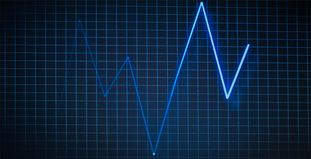 graphic illustration of heart pulse rate